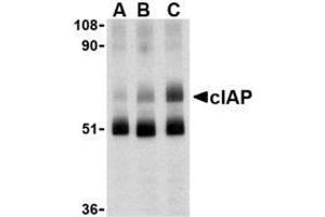 Western blot analysis of c-IAP in human lung lysate with AP30228PU-N c-IAP antibody at 1 (lane A), 2 (lane B), and 4 (lane C) μg/ml, respectively. (BIRC2 antibody  (C-Term))