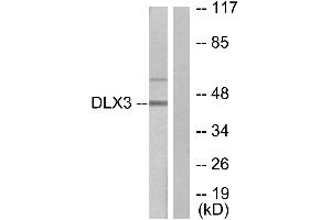 Immunohistochemistry analysis of paraffin-embedded human heart tissue using DLX3 antibody. (DLX3 antibody  (Internal Region))