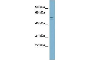 Human NCI-H226; WB Suggested Anti-ACD Antibody Titration: 0. (ACD antibody  (Middle Region))