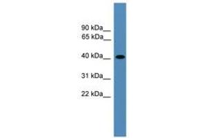 Image no. 1 for anti-Aminoacyl tRNA Synthetase Complex-Interacting Multifunctional Protein 2 (AIMP2) (AA 151-200) antibody (ABIN6745294) (AIMP2 antibody  (AA 151-200))