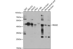 Western blot analysis of extracts of various cell lines, using RGS20 antibody (ABIN6132187, ABIN6146920, ABIN6146921 and ABIN6224191) at 1:1000 dilution. (RGS20 antibody  (AA 1-241))