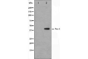 Western blot analysis on 293 cell lysate using Pax-5 Antibody.