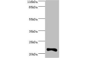 Western blot All lanes: IFNA10 antibody at 2 μg/mL + Mouse kidney tissue Secondary Goat polyclonal to rabbit IgG at 1/10000 dilution Predicted band size: 22 kDa Observed band size: 22 kDa (IFNA1 antibody  (AA 24-189))
