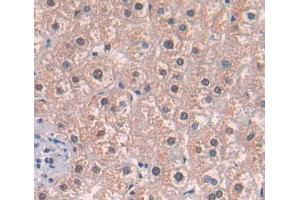 IHC-P analysis of liver tissue, with DAB staining. (Acetyl-CoA Carboxylase beta antibody  (AA 29-249))
