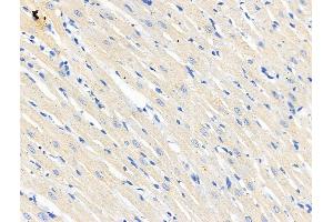 ABIN6265678 and ABIN6266689 at 1/100 staining Rat heart tissue by IHC-P. (TP53I11 antibody  (N-Term))