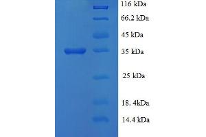SDS-PAGE (SDS) image for Lysine (K)-Specific Demethylase 5A (KDM5A) (AA 437-603) protein (His-SUMO Tag) (ABIN5709797) (KDM5A Protein (AA 437-603) (His-SUMO Tag))