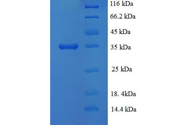 KDM5A Protein (AA 437-603) (His-SUMO Tag)