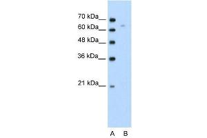 Human Jurkat; WB Suggested Anti-TOX Antibody Titration: 0. (TOX antibody  (N-Term))