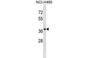 Western Blotting (WB) image for anti-CutC Copper Transporter Homolog (CUTC) antibody (ABIN2999019) (CUTC antibody)