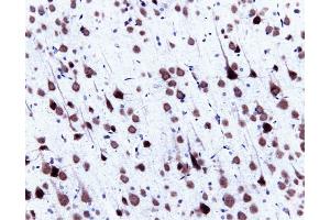 Immunohistochemical staining of pyrimidal cells in a rat cortex, formalin-fixed paraffin-embedded tissue section, with citrate pre-treatment (magnification, 20X). (SNRPN antibody  (AA 14-174))