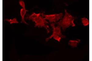 Immunofluorescence (fixed cells) (IF/ICC) image for anti-Inhibitor of kappa Light Polypeptide Gene Enhancer in B-Cells, Kinase gamma (IKBKG) (pSer85) antibody (ABIN6255538)