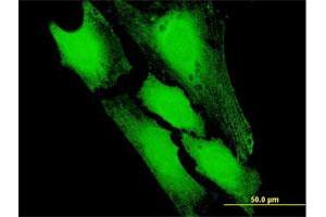 Immunofluorescence of purified MaxPab antibody to PFDN5 on HeLa cell. (PFDN5 antibody  (AA 1-154))