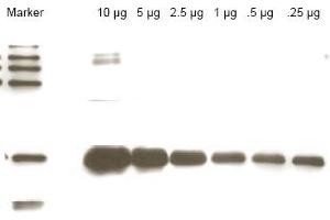 Western blot using anti-Yeast ULP-1 antibody shows detection of a truncated ULP-1 fusion protein (arrowhead). (ULP1 antibody)