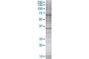 TP53I3 transfected lysate (TP53I3 293T Cell Transient Overexpression Lysate(Denatured))
