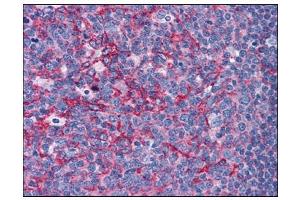 Human Tonsil: Formalin-Fixed, Paraffin-Embedded (FFPE) (Flotillin 2 antibody  (C-Term))