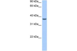 Western Blotting (WB) image for anti-AlkB, Alkylation Repair Homolog 8 (ALKBH8) antibody (ABIN2462329) (ALKBH8 antibody)