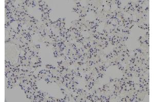 ABIN6277745 at 1/100 staining Rat lung tissue by IHC-P. (MDM4-binding Protein antibody  (Internal Region))