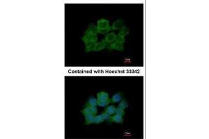 ICC/IF Image Immunofluorescence analysis of paraformaldehyde-fixed A431, using ABR, antibody at 1:500 dilution. (ABR antibody  (C-Term))