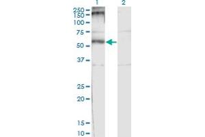 Western Blot analysis of CHRND expression in transfected 293T cell line by CHRND monoclonal antibody (M01), clone 2B2. (CHRND antibody  (AA 24-130))