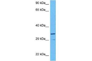Western Blotting (WB) image for anti-Wingless-Type MMTV Integration Site Family, Member 7B (WNT7B) (Middle Region) antibody (ABIN2776732)