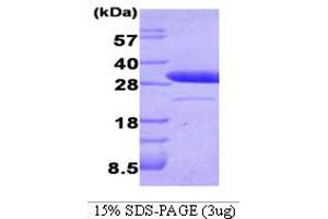 SDS-PAGE (SDS) image for Latexin (LXN) (AA 1-222) protein (ABIN666749) (Latexin Protein (LXN) (AA 1-222))