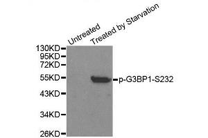 Western blot analysis of extracts from 293 cells, using Phospho-G3BP1-S232 antibody (ABIN2988019). (G3BP1 antibody  (pSer232))