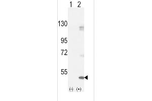 Western blot analysis of FGFR1 (arrow) using rabbit polyclonal FGFR1-p h. (FGFR1 antibody  (AA 132-161))