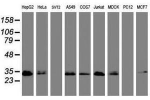 Image no. 3 for anti-Palmitoyl-Protein Thioesterase 1 (PPT1) (AA 100-306) antibody (ABIN1490801) (PPT1 antibody  (AA 100-306))