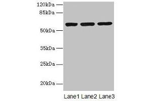 Western blot All lanes: MIER2 antibody at 4 μg/mL Lane 1: Jurkat whole cell lysate Lane 2: HepG2 whole cell lysate Lane 3: A549 whole cell lysate Secondary Goat polyclonal to rabbit IgG at 1/10000 dilution Predicted band size: 60 kDa Observed band size: 60 kDa (MIER2 antibody  (AA 1-545))