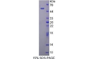 Image no. 1 for BPI Fold Containing Family A, Member 1 (BPIFA1) (AA 20-256) protein (His tag,GST tag) (ABIN4990693) (BPIFA1 Protein (AA 20-256) (His tag,GST tag))