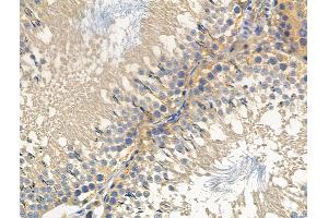 ABIN6256975 and ABIN6275033 at 1/100 staining Rat testis tissue by IHC-P. (C1QBP antibody  (Internal Region))
