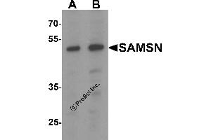 Western Blotting (WB) image for anti-SAM Domain, SH3 Domain and Nuclear Localization Signals, 1 (SAMSN1) (C-Term) antibody (ABIN1077391) (SAMSN1 antibody  (C-Term))