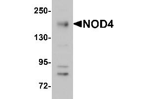 Western Blotting (WB) image for anti-NLR Family, CARD Domain Containing 5 (NLRC5) (N-Term) antibody (ABIN1031483) (NLRC5 antibody  (N-Term))