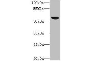 Western blot All lanes: SOAT2 antibody IgG at 3. (SOAT2 antibody  (AA 1-120))