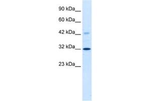Western Blotting (WB) image for anti-Voltage-Dependent Anion Channel 1 (VDAC1) antibody (ABIN2461102) (VDAC1 antibody)
