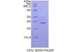 SDS-PAGE (SDS) image for Sclerostin Domain Containing 1 (SOSTDC1) (AA 24-206) protein (His tag) (ABIN1878140)