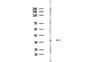 anti-Lysophosphatidic Acid Receptor 2 (LPAR2) (C-Term) antibody