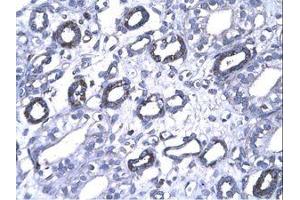 Image no. 3 for anti-Forkhead Box P1 (FOXP1) (AA 223-270) antibody (ABIN202867) (FOXP1 antibody  (AA 223-270))