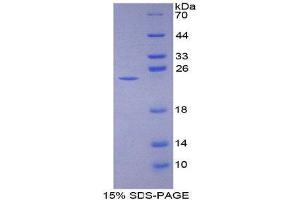 SDS-PAGE (SDS) image for Neutrophil Cytosolic Factor 2 (NCF2) (AA 355-526) protein (His tag) (ABIN2126070) (NCF2 Protein (AA 355-526) (His tag))