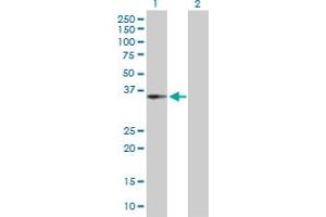 Western Blot analysis of CENPH expression in transfected 293T cell line by CENPH MaxPab polyclonal antibody. (CENPH antibody  (AA 1-247))