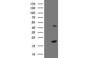Image no. 1 for anti-Eukaryotic Translation Initiation Factor 5A2 (EIF5A2) antibody (ABIN1497998) (EIF5A2 antibody)