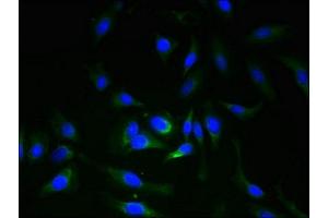 Immunofluorescent analysis of Hela cells using ABIN7151699 at dilution of 1:100 and Alexa Fluor 488-congugated AffiniPure Goat Anti-Rabbit IgG(H+L) (ERGIC3 antibody  (AA 47-341))