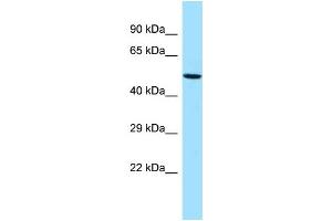 Western Blotting (WB) image for anti-G Patch Domain Containing 4 (GPATCH4) (C-Term) antibody (ABIN2789259)