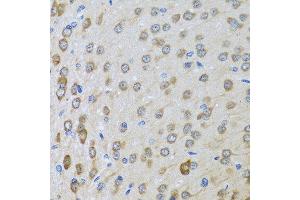 Immunohistochemistry of paraffin-embedded rat brain using BTD antibody at dilution of 1:100 (40x lens). (BTD antibody)