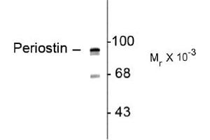 Image no. 1 for anti-Periostin (POSTN) (C-Term) antibody (ABIN372700)