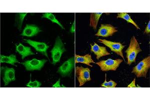 ICC/IF Image MX1 antibody [N2C2], Internal detects MX1 protein at cytoplasm by immunofluorescent analysis. (MX1 antibody  (Internal Region))