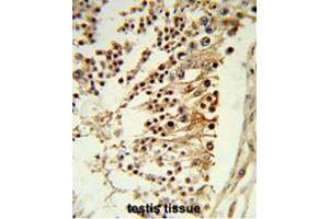 Formalin-fixed and paraffin-embedded human testis tissue reacted with CENPH Antibody (Center), which was peroxidase-conjugated to the secondary antibody, followed by DAB staining. (CENPH antibody  (Middle Region))