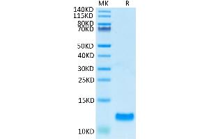 CCL20 Protein (AA 27-96) (His tag)
