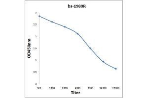 Antigen: 0. (MASP2 antibody  (AA 351-450))