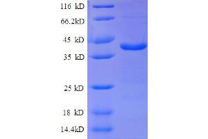 SDS-PAGE (SDS) image for ATPase, H+ Transporting, Lysosomal 14kDa, V1 Subunit F (ATP6V1F) (AA 1-119), (full length) protein (GST tag) (ABIN5712163)